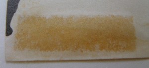 Vor der Restaurierung: rückseitig auf einer Grafik angebrachtes Selbstklebeband hinterließ diesen zur Vorderseite durchgeschlagenen Fleck Vor der Restaurierung: rückseitig auf einer Grafik angebrachtes Selbstklebeband hinterließ diesen zur Vorderseite durchgeschlagenen Fleck